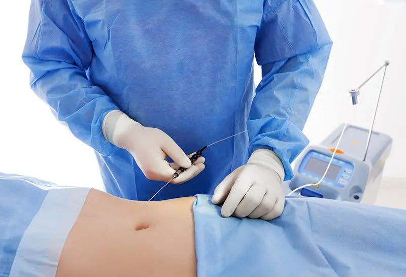 Laserlipolisis