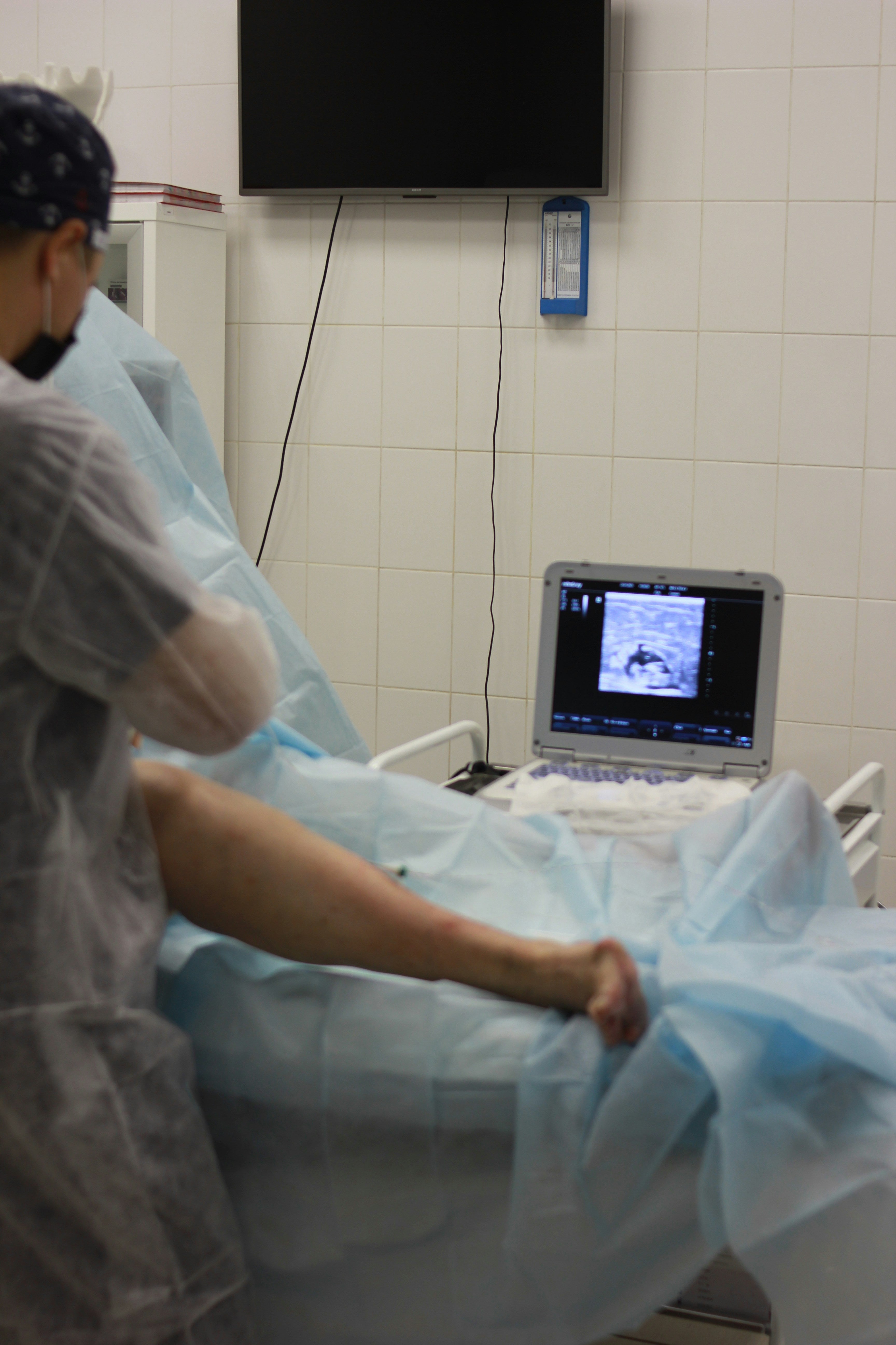 Tratamiento de varices con cirugía
